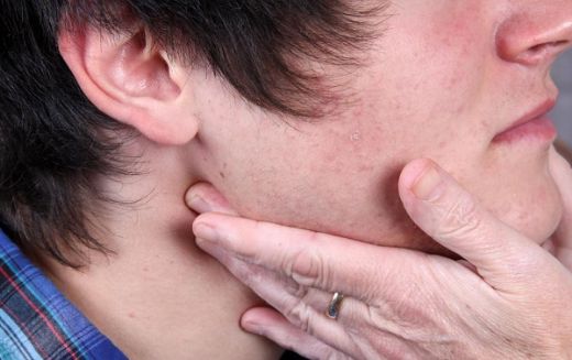 Boğazda Şişlik Belirtileri ve Tedavisi